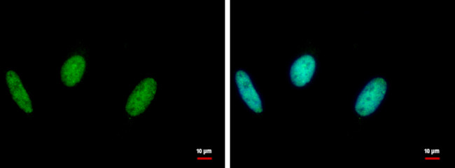 RAD18 Antibody in Immunocytochemistry (ICC/IF)