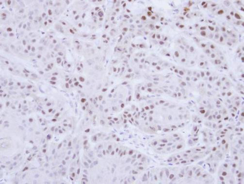 RAD18 Antibody in Immunohistochemistry (Paraffin) (IHC (P))