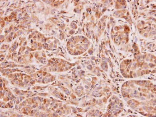 NAT2 Antibody in Immunohistochemistry (Paraffin) (IHC (P))