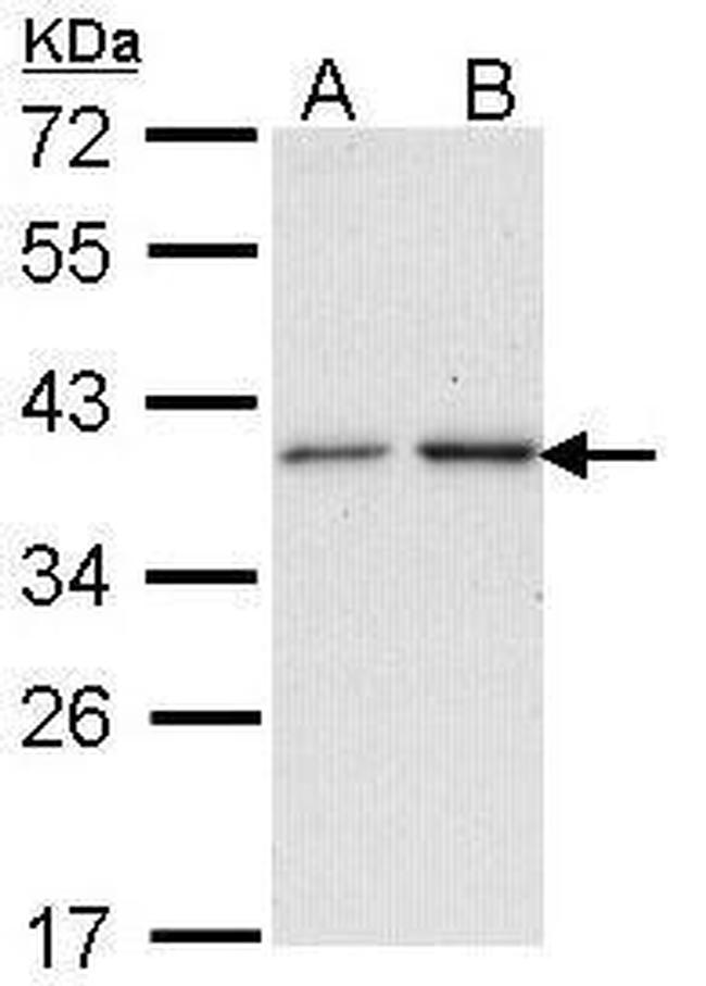 NAT2 Antibody in Western Blot (WB)