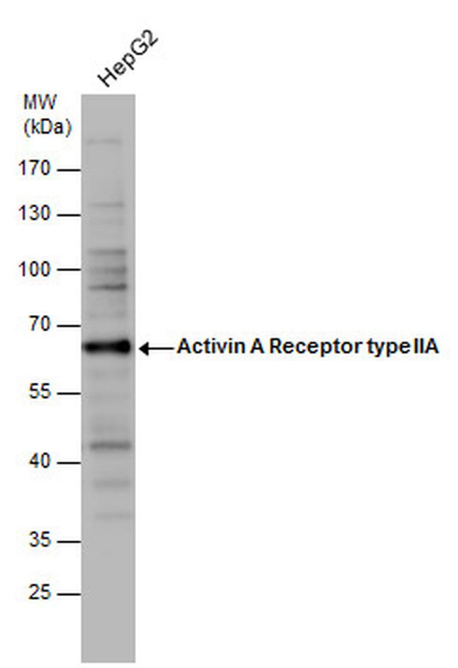 ACVR2A Antibody in Western Blot (WB)