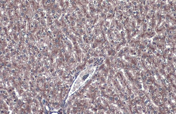 GBA Antibody in Immunohistochemistry (Paraffin) (IHC (P))