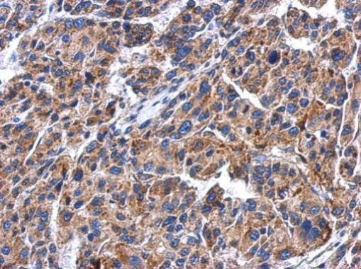 GBA Antibody in Immunohistochemistry (Paraffin) (IHC (P))