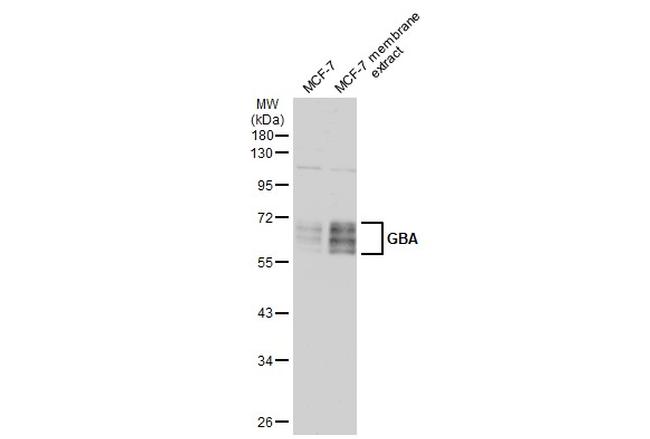 GBA Antibody in Western Blot (WB)