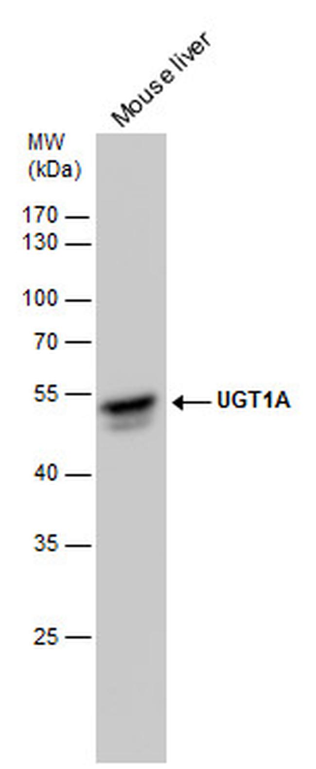 UGT1A9 Antibody in Western Blot (WB)