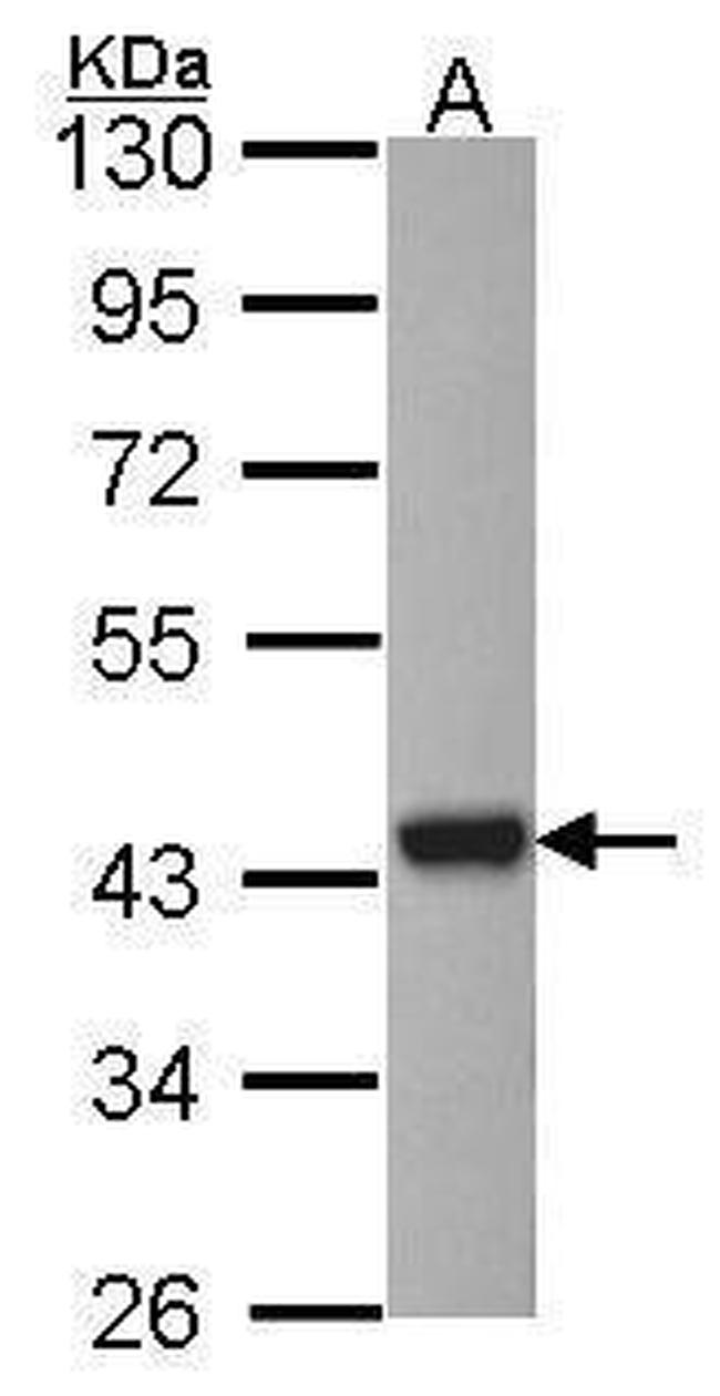 Arylsulfatase A Antibody in Western Blot (WB)