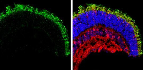 GNAT2 Antibody in Immunohistochemistry (Frozen) (IHC (F))