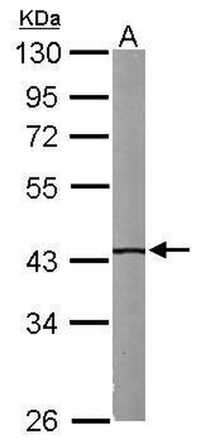 IVD Antibody in Western Blot (WB)