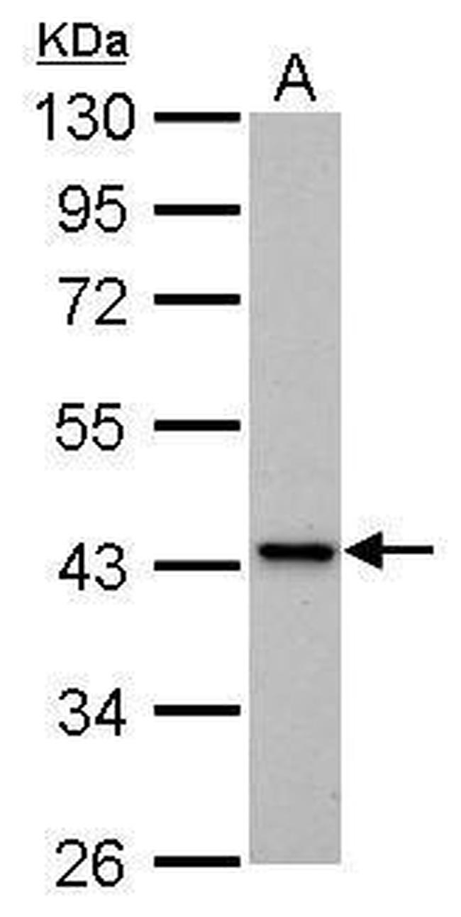 IVD Antibody in Western Blot (WB)