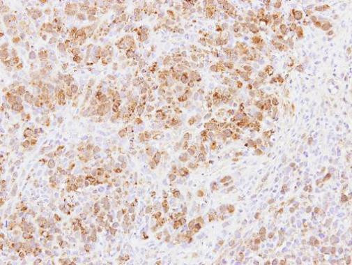 PABPC3 Antibody in Immunohistochemistry (Paraffin) (IHC (P))