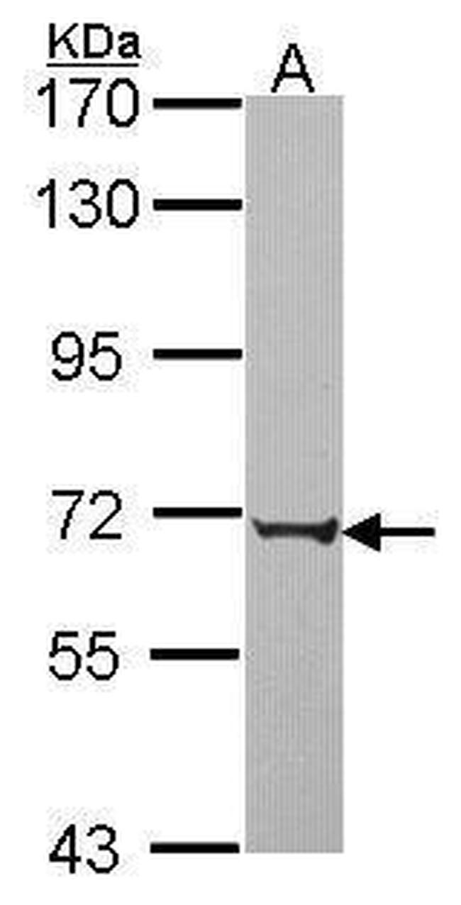 PABPC3 Antibody in Western Blot (WB)