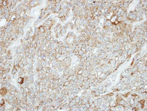 PCDH1 Antibody in Immunohistochemistry (Paraffin) (IHC (P))