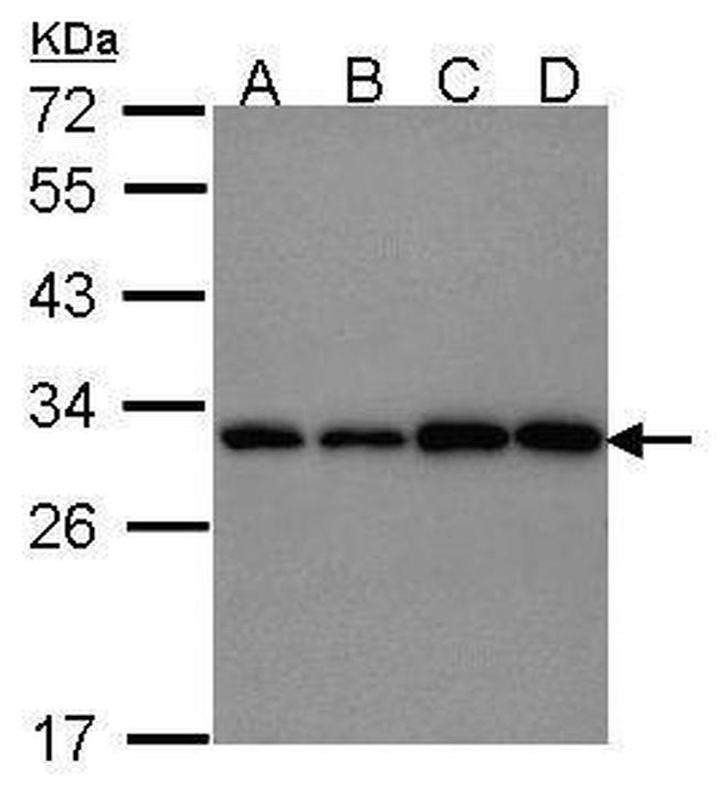 PGAM1 Antibody in Western Blot (WB)