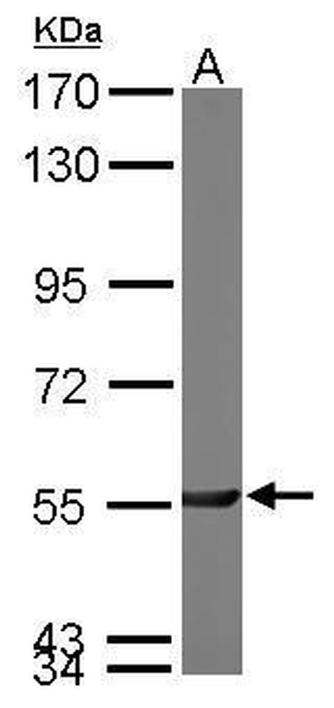 PGM3 Antibody in Western Blot (WB)