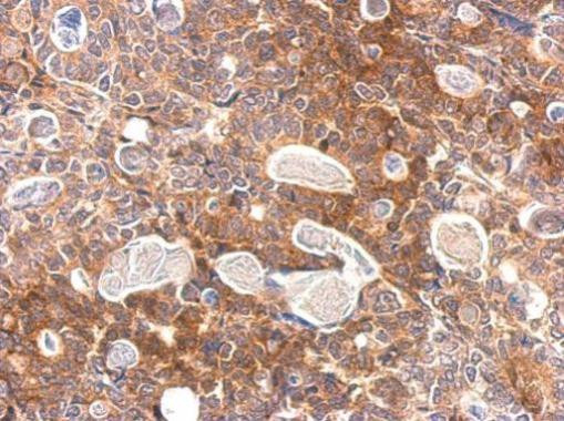 SLA Antibody in Immunohistochemistry (Paraffin) (IHC (P))