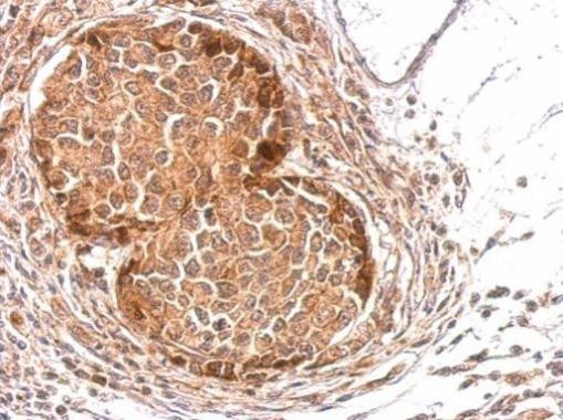 SLA Antibody in Immunohistochemistry (Paraffin) (IHC (P))