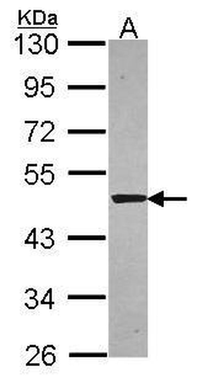 Syntrophin alpha-1 Antibody in Western Blot (WB)