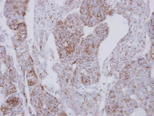 NDUFS2 Antibody in Immunohistochemistry (Paraffin) (IHC (P))