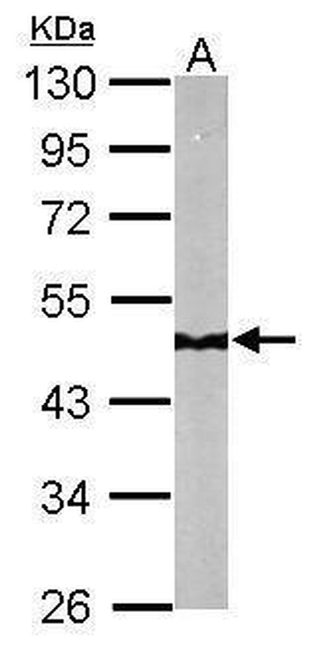 NDUFS2 Antibody in Western Blot (WB)