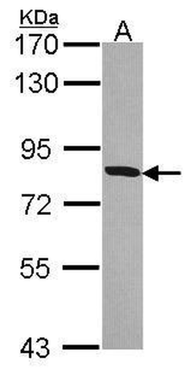 HSD17B4 Antibody in Western Blot (WB)