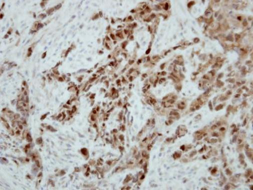 Ataxin 3 Antibody in Immunohistochemistry (Paraffin) (IHC (P))