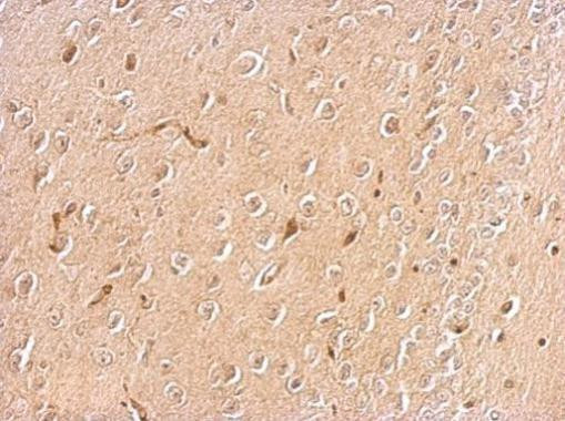 Chromogranin C Antibody in Immunohistochemistry (Paraffin) (IHC (P))