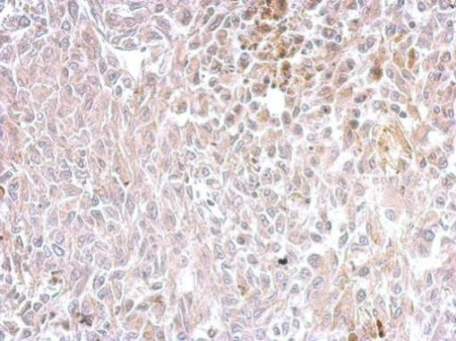 Chromogranin C Antibody in Immunohistochemistry (Paraffin) (IHC (P))