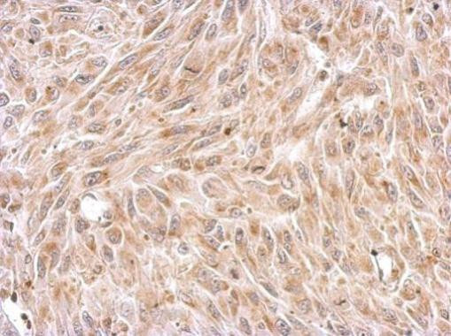 Chromogranin C Antibody in Immunohistochemistry (Paraffin) (IHC (P))