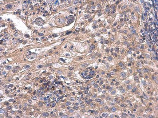 ACOX3 Antibody in Immunohistochemistry (Paraffin) (IHC (P))