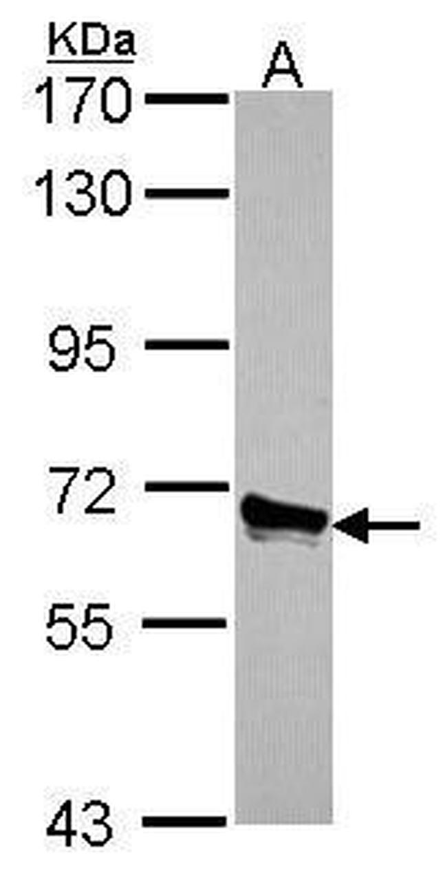 ACOX3 Antibody in Western Blot (WB)