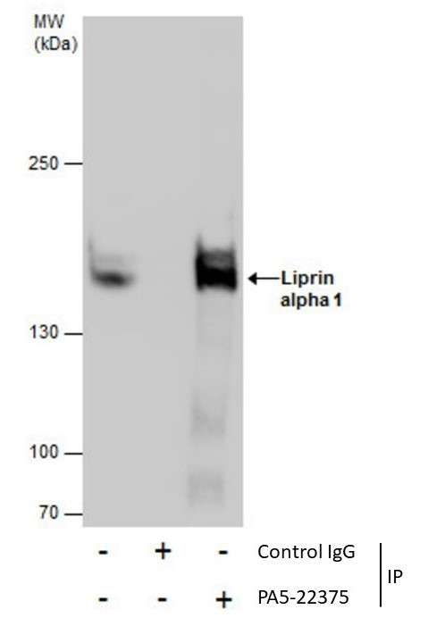 PPFIA1 Antibody in Immunoprecipitation (IP)