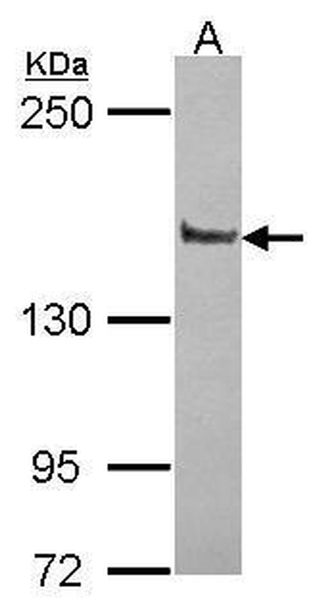 PPFIA1 Antibody in Western Blot (WB)