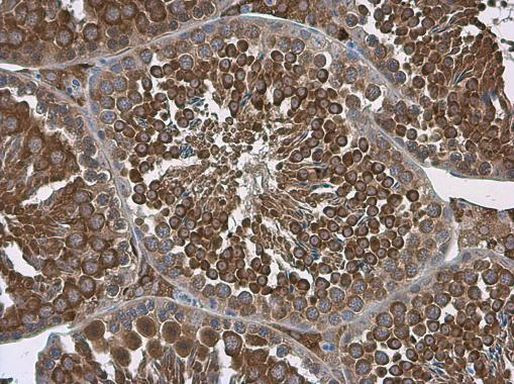 ALDH1A2 Antibody in Immunohistochemistry (Paraffin) (IHC (P))