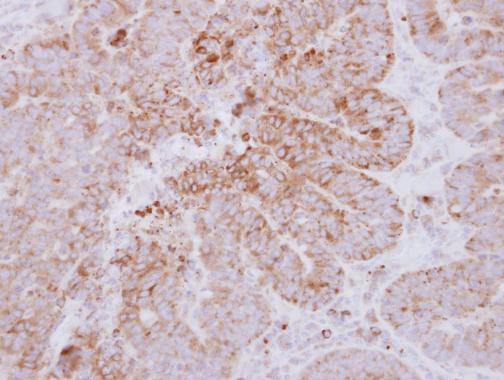 GYG2 Antibody in Immunohistochemistry (Paraffin) (IHC (P))