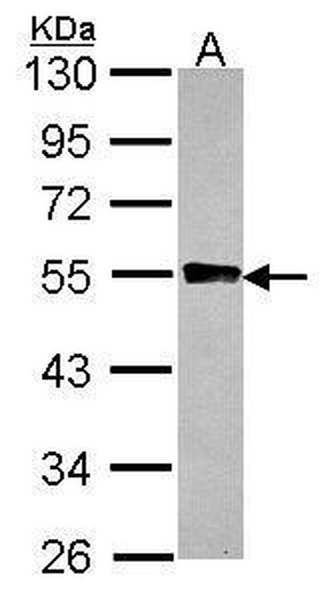 GYG2 Antibody in Western Blot (WB)