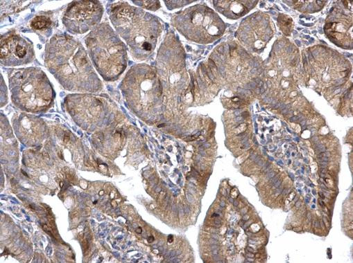 H-Ras Antibody in Immunohistochemistry (Paraffin) (IHC (P))