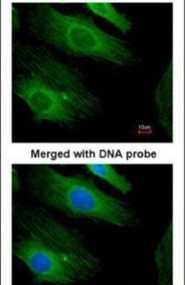 H-Ras Antibody in Immunocytochemistry (ICC/IF)