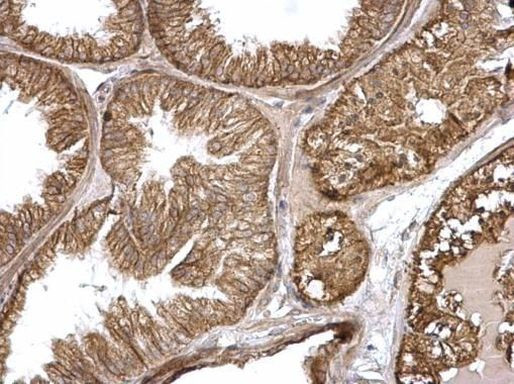 H-Ras Antibody in Immunohistochemistry (Paraffin) (IHC (P))