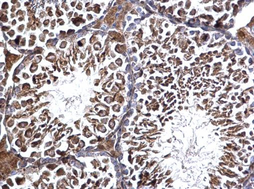 EDC3 Antibody in Immunohistochemistry (Paraffin) (IHC (P))