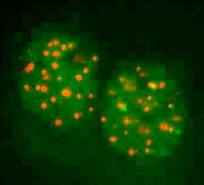 FANCD2 Antibody in Immunocytochemistry (ICC/IF)