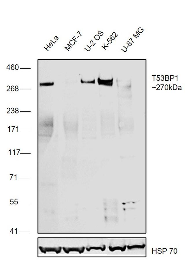 53BP1 Antibody in Western Blot (WB)