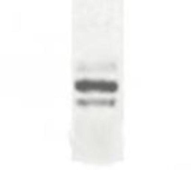 DCBLD2 Antibody in Western Blot (WB)