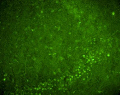 Nurr1 Antibody in Immunohistochemistry (PFA fixed) (IHC (PFA))