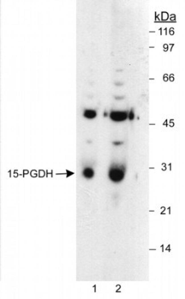 15-PGDH Antibody in Western Blot (WB)