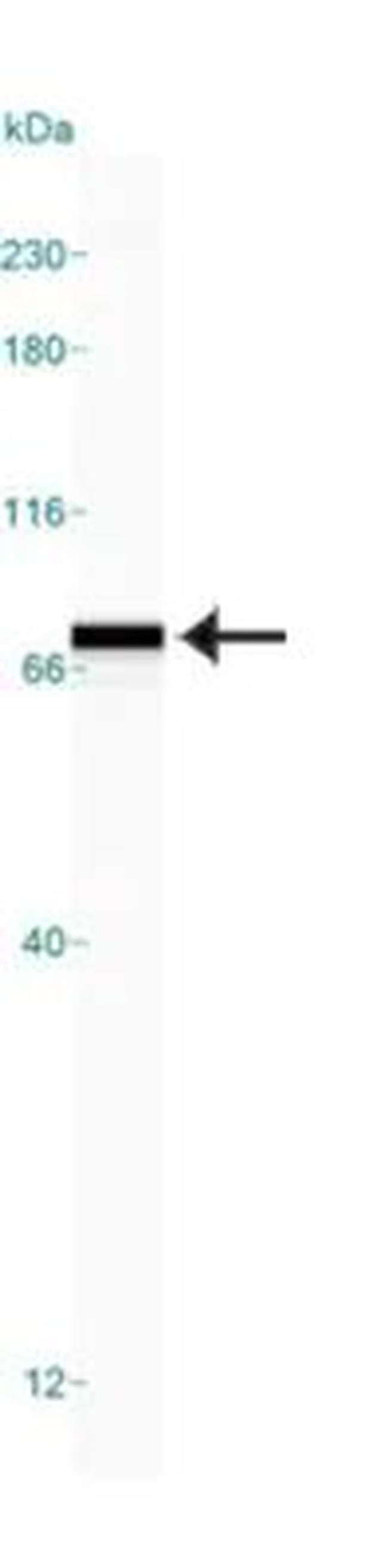 GRP78 Antibody in Western Blot (WB)