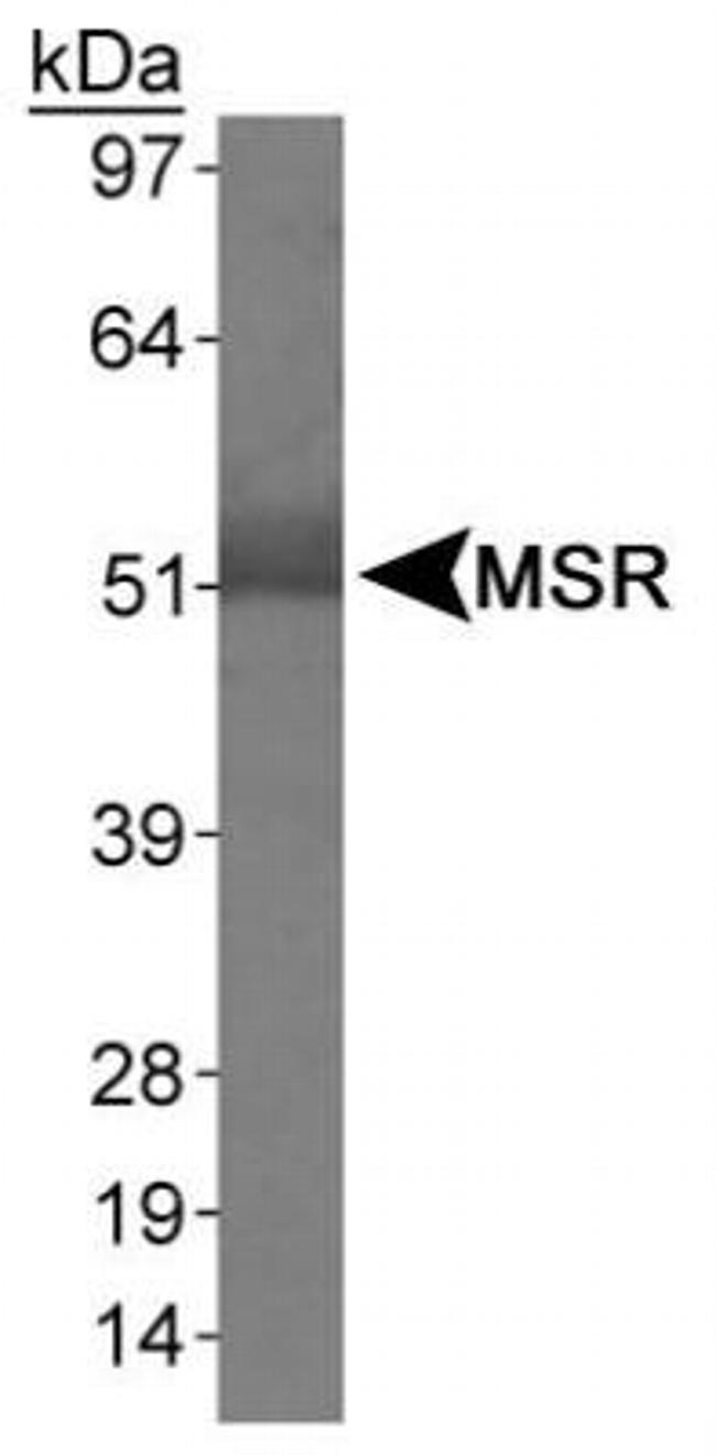 CD204 Antibody in Western Blot (WB)