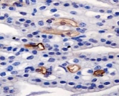 AGR2 Antibody in Immunohistochemistry (Paraffin) (IHC (P))