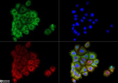 AGR2 Antibody in Immunocytochemistry (ICC/IF)