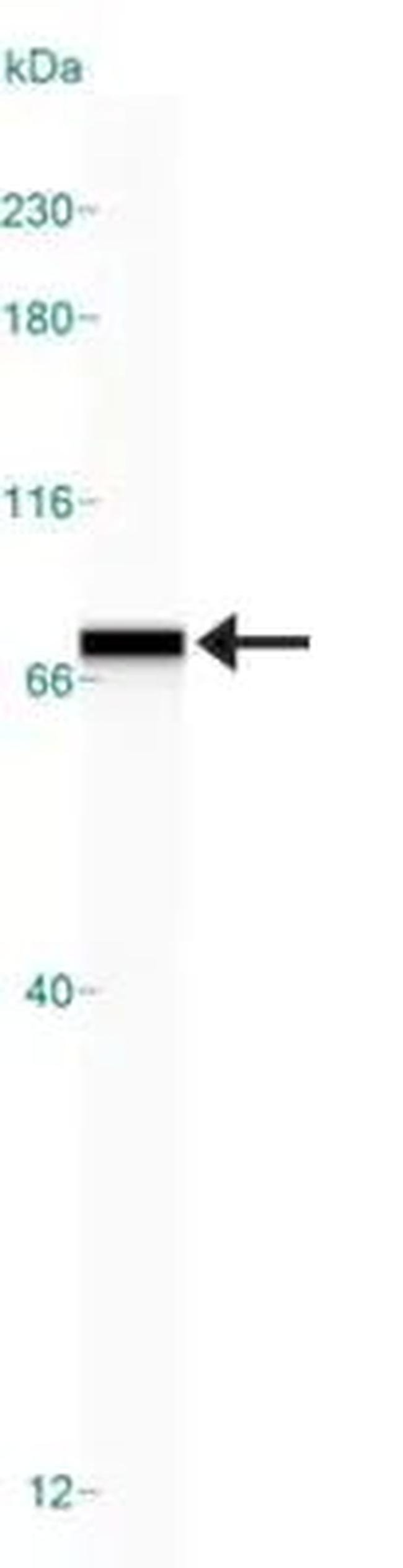 GRP78 Antibody in Western Blot (WB)