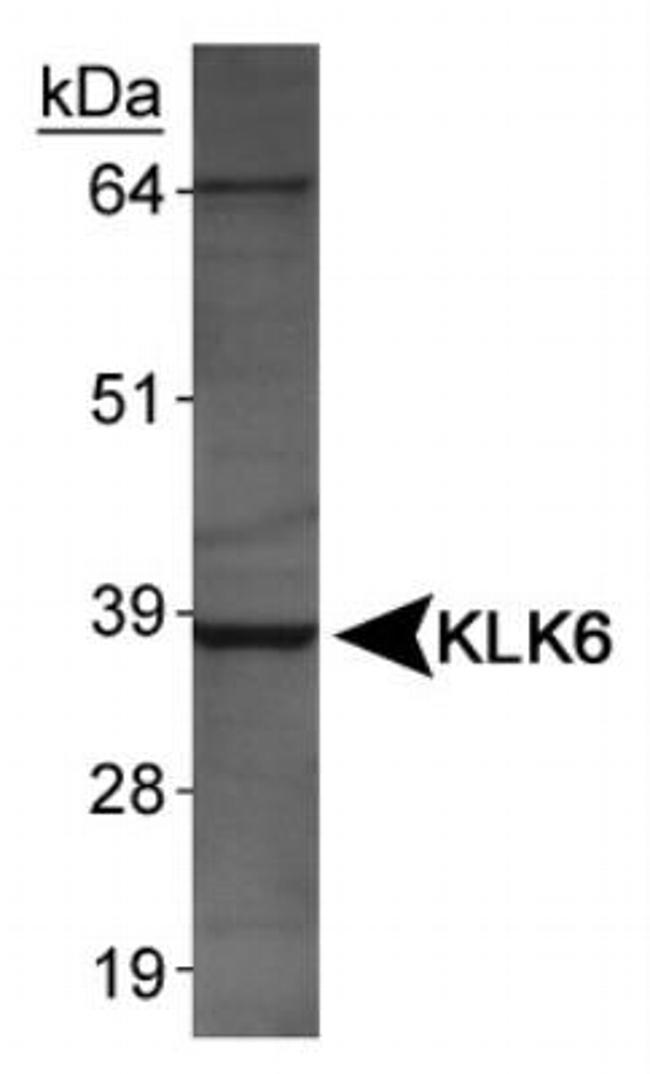 Kallikrein 6 Antibody in Western Blot (WB)